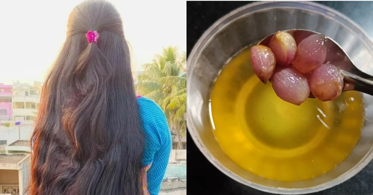 Small Onion Oil For Fast Hair Growth