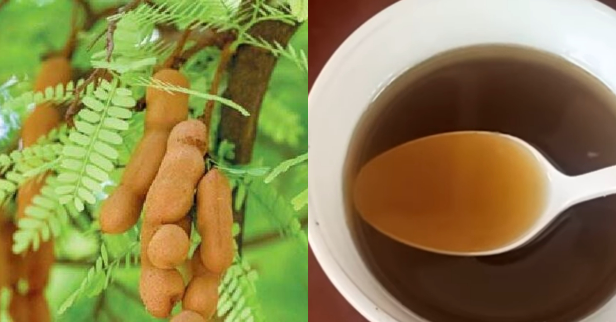 Headache relief tips