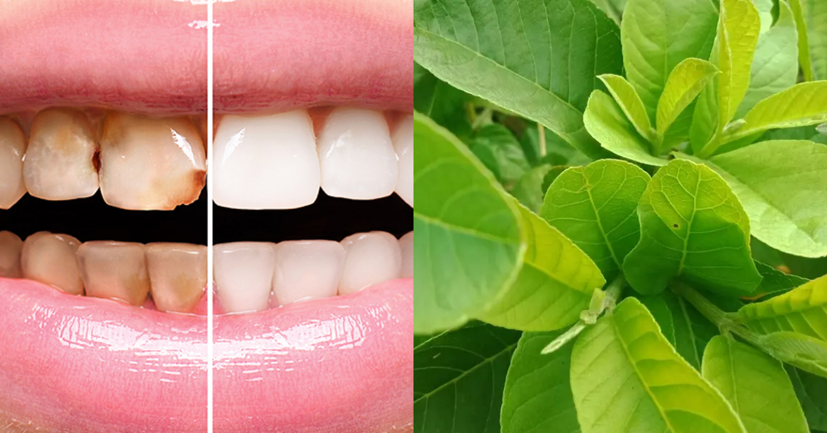 Teeth health care tips