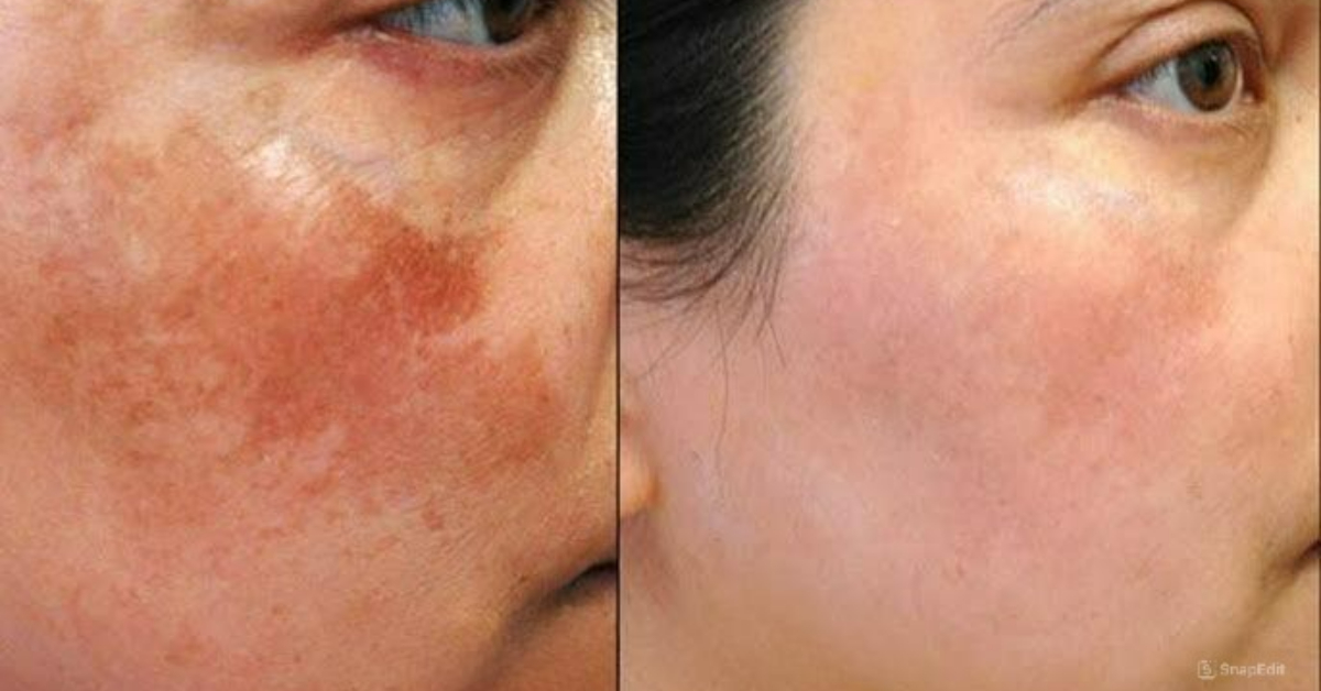 face Brightening tips at home